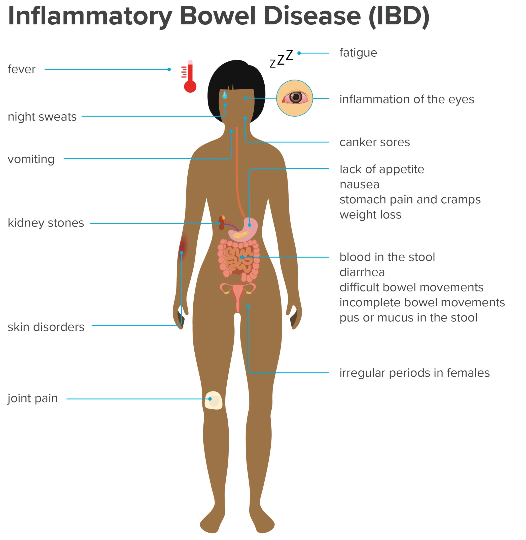 IBD TREATMENT