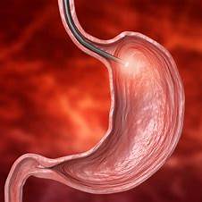 GI Cancer Treatment