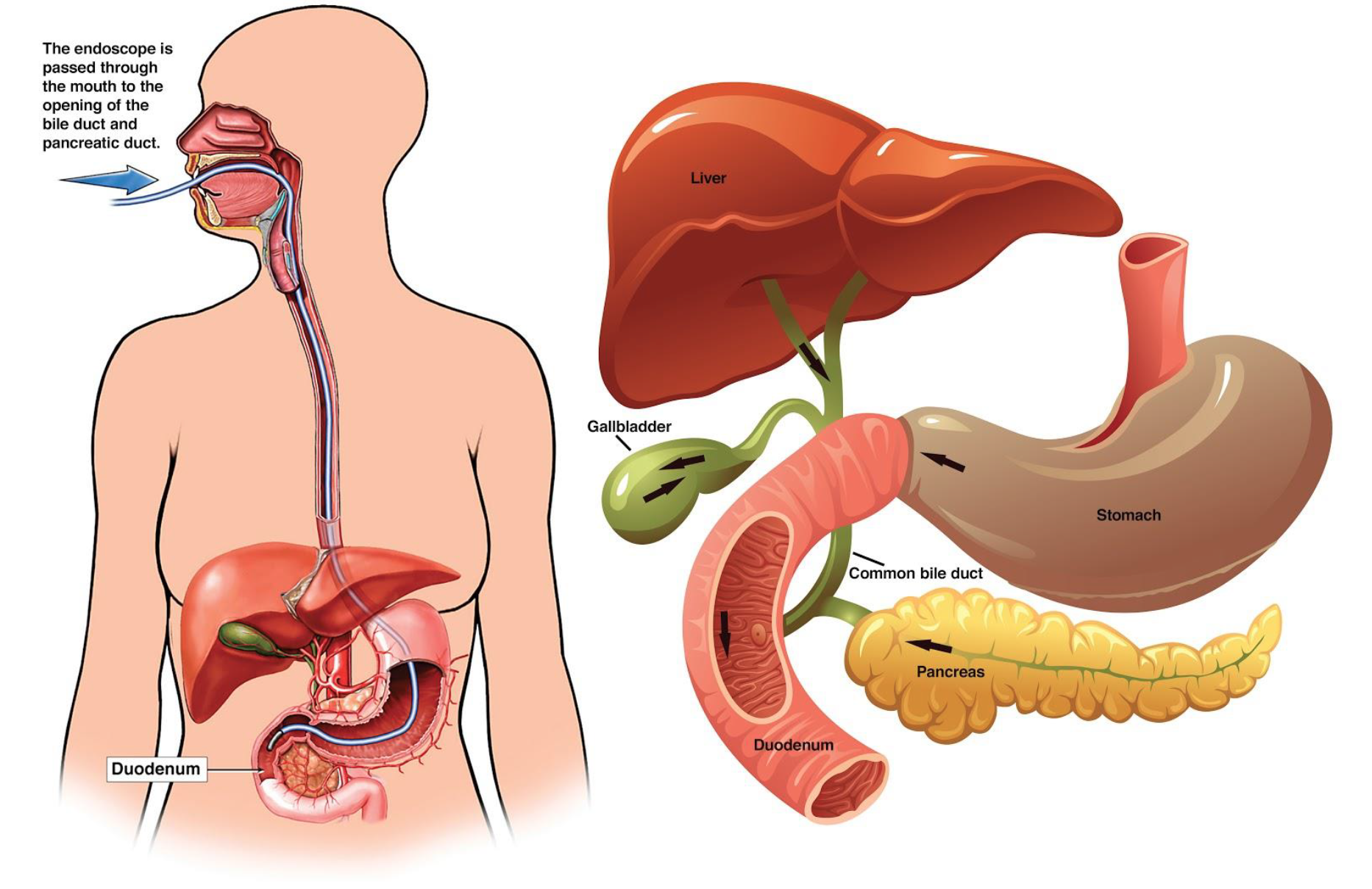 ERCP Treatment